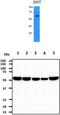Pyruvate Kinase L/R antibody, MBS200204, MyBioSource, Western Blot image 