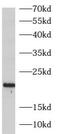 ADP Ribosylation Factor Like GTPase 3 antibody, FNab00576, FineTest, Western Blot image 