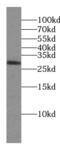 Lin-28 Homolog A antibody, FNab04784, FineTest, Western Blot image 