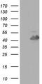Troponin T2, Cardiac Type antibody, CF804461, Origene, Western Blot image 