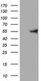 Keratin 24 antibody, NBP2-45558, Novus Biologicals, Western Blot image 