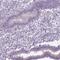 Chromosome 20 Open Reading Frame 144 antibody, HPA019029, Atlas Antibodies, Immunohistochemistry frozen image 