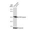 Poly(ADP-Ribose) Polymerase 1 antibody, GTX00943, GeneTex, Western Blot image 