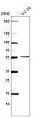Melanoma antigen preferentially expressed in tumors antibody, AMAb91329, Atlas Antibodies, Western Blot image 