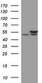 Tubulin Beta 2B Class IIb antibody, TA506602, Origene, Western Blot image 