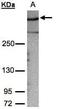 A-Kinase Anchoring Protein 12 antibody, PA5-21759, Invitrogen Antibodies, Western Blot image 