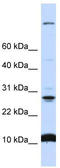 WD Repeat Domain 83 Opposite Strand antibody, TA341999, Origene, Western Blot image 