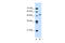 Collagen alpha-2(VI) chain antibody, 30-119, ProSci, Enzyme Linked Immunosorbent Assay image 