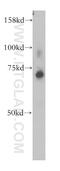 Zinc Finger Protein 443 antibody, 13667-1-AP, Proteintech Group, Western Blot image 