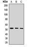 Porcupine O-Acyltransferase antibody, orb411957, Biorbyt, Western Blot image 