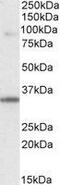 LIM Domain Binding 3 antibody, GTX89478, GeneTex, Western Blot image 
