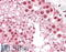 Monoglyceride Lipase antibody, 45-896, ProSci, Immunohistochemistry frozen image 