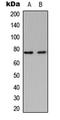 Glyceronephosphate O-Acyltransferase antibody, LS-C356067, Lifespan Biosciences, Western Blot image 