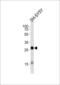 Glycoprotein M6A antibody, 63-902, ProSci, Western Blot image 