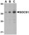 Suppressor Of Cytokine Signaling 1 antibody, TA306303, Origene, Western Blot image 