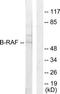 Serine/threonine-protein kinase B-raf antibody, TA326224, Origene, Western Blot image 