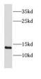 D-Dopachrome Tautomerase antibody, FNab02293, FineTest, Western Blot image 