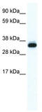 Annexin A5 antibody, TA341703, Origene, Western Blot image 