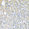 Ubiquinol-Cytochrome C Reductase Core Protein 2 antibody, 19-301, ProSci, Immunohistochemistry paraffin image 