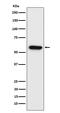 Synapsin II antibody, M08488-1, Boster Biological Technology, Western Blot image 