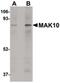 N(Alpha)-Acetyltransferase 35, NatC Auxiliary Subunit antibody, PA5-20784, Invitrogen Antibodies, Western Blot image 
