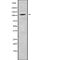 Chloride Voltage-Gated Channel 1 antibody, abx149376, Abbexa, Western Blot image 