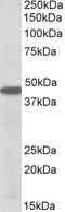 Aldehyde Dehydrogenase 3 Family Member A1 antibody, 42-611, ProSci, Immunohistochemistry frozen image 