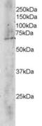 Transducin Beta Like 1 X-Linked antibody, EB05313, Everest Biotech, Western Blot image 