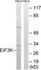 Eukaryotic translation initiation factor 3 subunit K antibody, TA312740, Origene, Western Blot image 