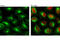 Signal transducer and activator of transcription 1-alpha/beta antibody, 8183S, Cell Signaling Technology, Immunocytochemistry image 