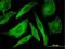 Mitogen-activated protein kinase 12 antibody, H00006300-M01, Novus Biologicals, Immunocytochemistry image 