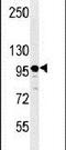 SEZ6L2 antibody, PA5-24862, Invitrogen Antibodies, Western Blot image 