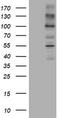 ALK Receptor Tyrosine Kinase antibody, TA801031, Origene, Western Blot image 