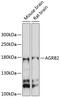 Adhesion G Protein-Coupled Receptor B2 antibody, 14-386, ProSci, Western Blot image 