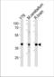 Neuronal Differentiation 1 antibody, TA324697, Origene, Western Blot image 