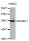 Keratin 7 antibody, abx000542, Abbexa, Western Blot image 