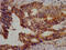Charged Multivesicular Body Protein 5 antibody, LS-C372176, Lifespan Biosciences, Immunohistochemistry paraffin image 