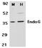 Endonuclease G, mitochondrial antibody, SP1412P, Origene, Western Blot image 