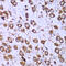 40S ribosomal protein S10 antibody, 19-990, ProSci, Immunohistochemistry paraffin image 