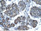 Small Nuclear RNA Activating Complex Polypeptide 1 antibody, 31-213, ProSci, Immunohistochemistry paraffin image 
