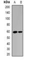 Recombination Activating 2 antibody, orb340947, Biorbyt, Western Blot image 