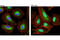p65 antibody, 6956S, Cell Signaling Technology, Immunocytochemistry image 
