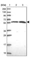 Rhophilin Rho GTPase Binding Protein 2 antibody, PA5-62469, Invitrogen Antibodies, Western Blot image 