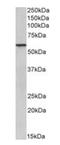 Epoxide Hydrolase 2 antibody, orb308868, Biorbyt, Western Blot image 