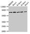 Solute Carrier Family 25 Member 12 antibody, LS-C672907, Lifespan Biosciences, Western Blot image 