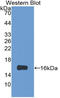 Galectin 1 antibody, LS-C314172, Lifespan Biosciences, Western Blot image 