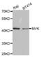 Mevalonate Kinase antibody, abx004095, Abbexa, Western Blot image 