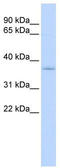 Sideroflexin 3 antibody, TA339575, Origene, Western Blot image 