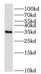 Forkhead Box S1 antibody, FNab03215, FineTest, Western Blot image 