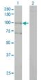 Alsin Rho Guanine Nucleotide Exchange Factor ALS2 antibody, H00057679-M01, Novus Biologicals, Western Blot image 